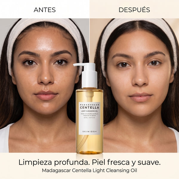 Aceite Limpiador Facial de Centella SKIN1004 Madagascar
