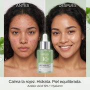 Sérum ANUA Ácido Azelaico 10% + Ácido Hialurónico