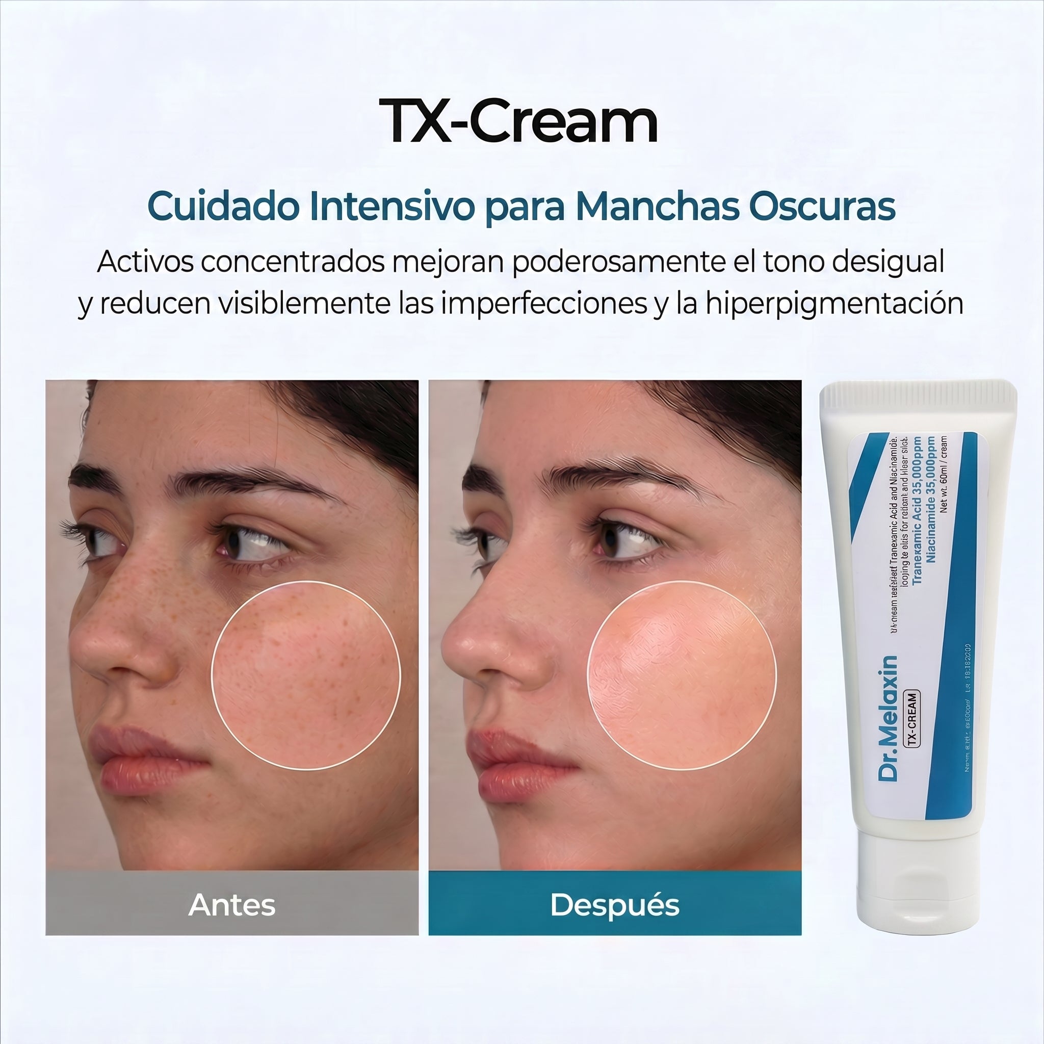 Dr. Melaxin TX-Crema – Crema Despigmentante