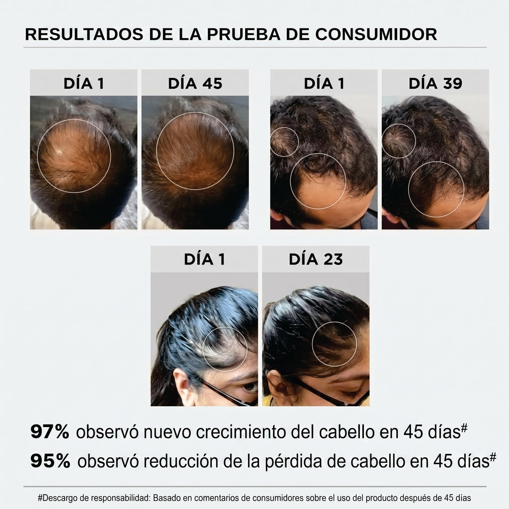 Sérum Avanzado Para el Crecimiento Capilar